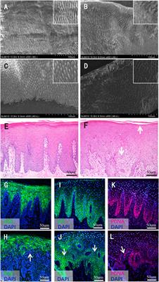 Rare compound heterozygous variants of LAMB3 and histological features of enamel and oral mucosa